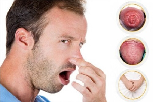 Cậu nhỏ có mùi hôi